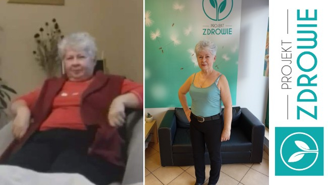 Pani Dorota: przed i po kuracji w Projekt Zdrowie Krosno.