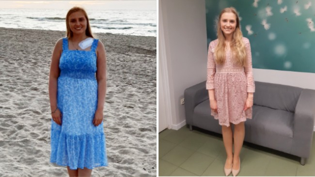 Sylwia przed i po kuracji z Projekt Zdrowie.